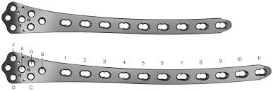 LOCKING DISTAL FEMUR PLATE 4.5MM, 5.0MM Manufacturers in Delhi